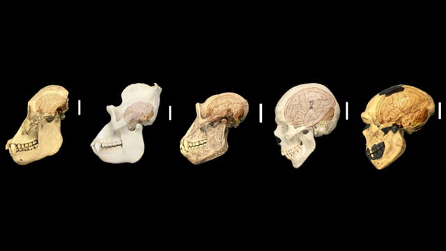 New Genetic Clues to the Mystery of Your Giant Brain [Video]